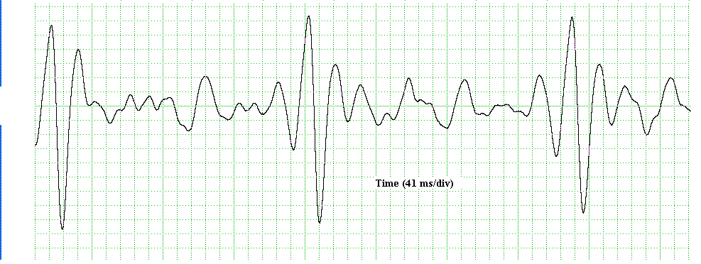 definition of cardiograph
